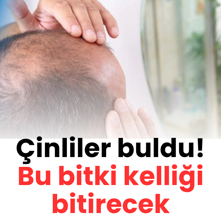 Çinliler buldu! Bu bitki kelliği bitirecek