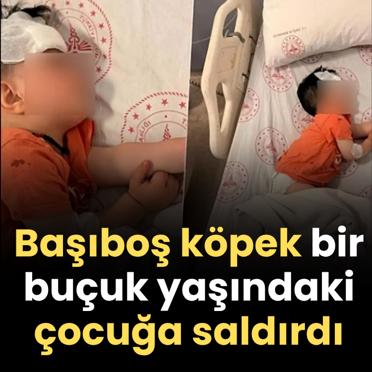 Başıboş köpek bir buçuk yaşındaki çocuğa saldırdı
