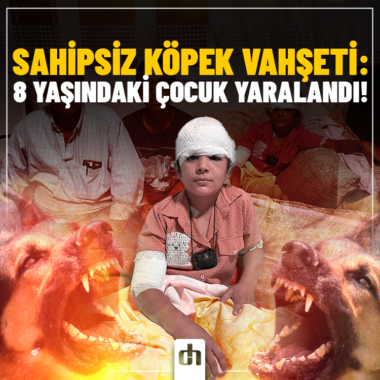 Sahipsiz köpek vahşeti: 8 yaşındaki çocuk yaralandı!