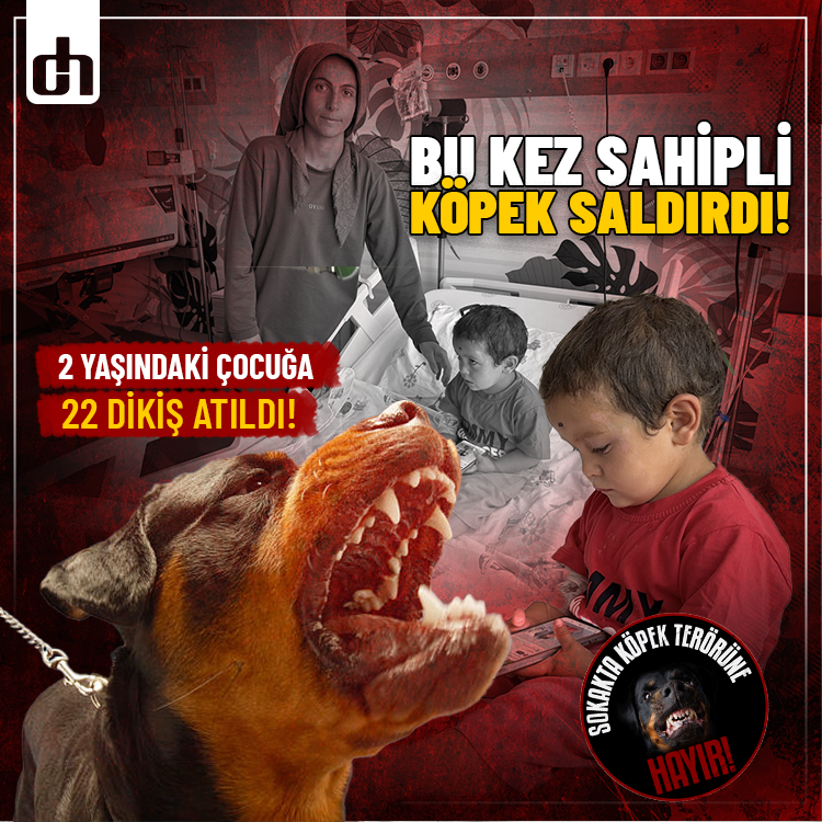 Bu kez sahipli köpek saldırdı: 2 yaşındaki çocuğa 22 dikiş atıldı!