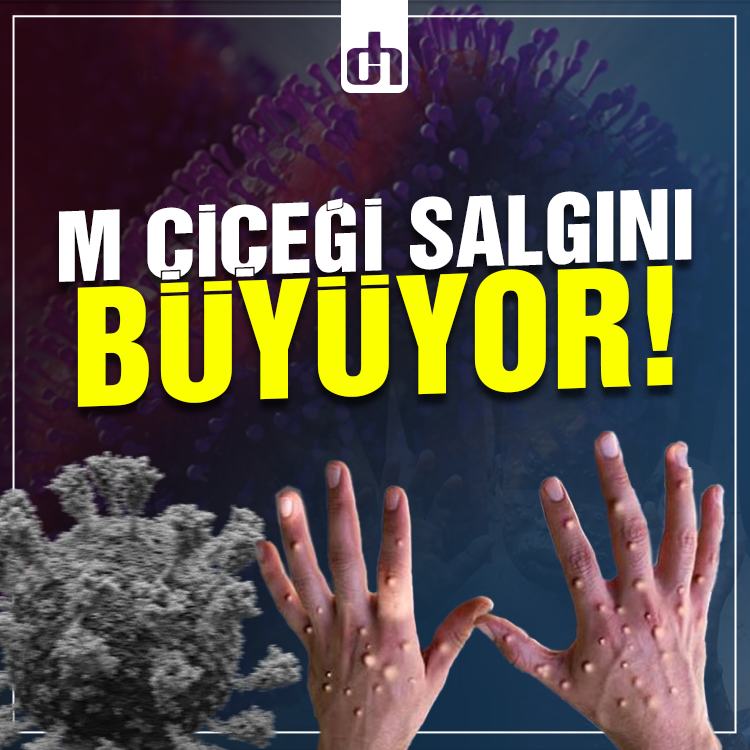 Madagaskar'da M çiçeği salgını yayılıyor: Vaka sayısı üç bini aştı