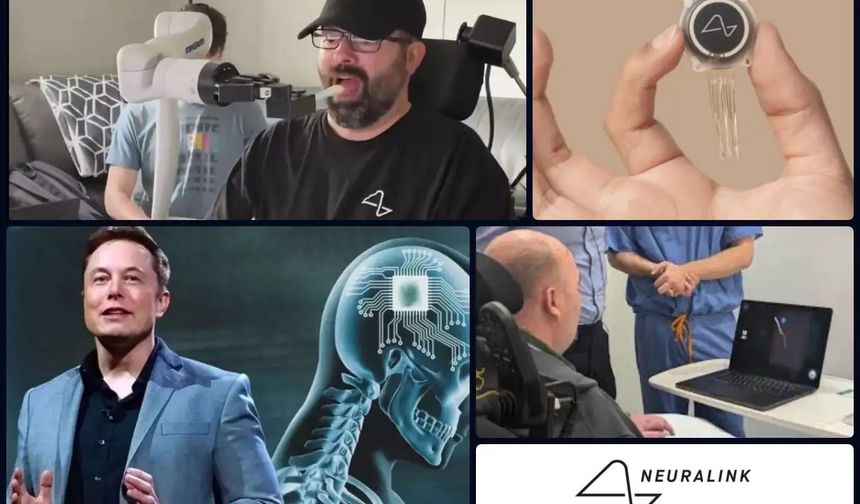 Beyin çipi sınırları aşıyor