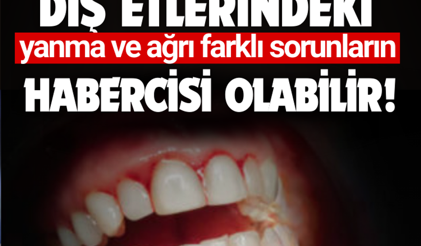 Diş etlerindeki yanma ve ağrı farklı sorunların habercisi olabilir!