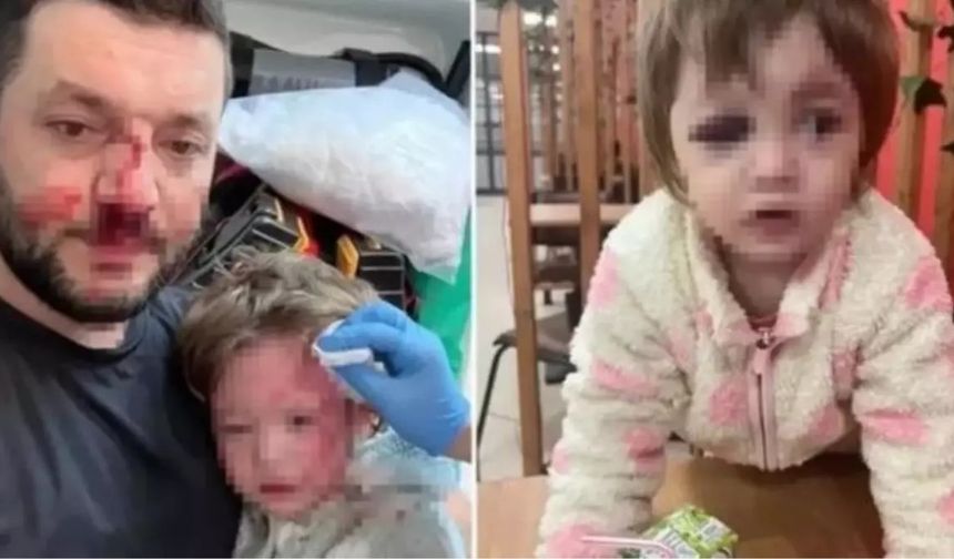 Yalova'daki saldırıya ilişkin son dakika: Bakanlık harekete geçti!