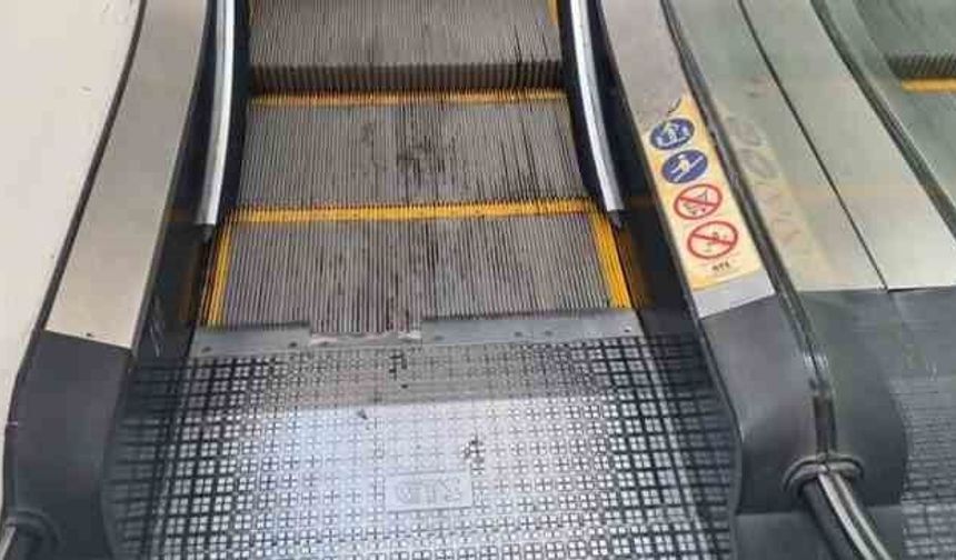 Yürüyen merdiven kazası: 3 yaşındaki çocuğun parmağı koptu!