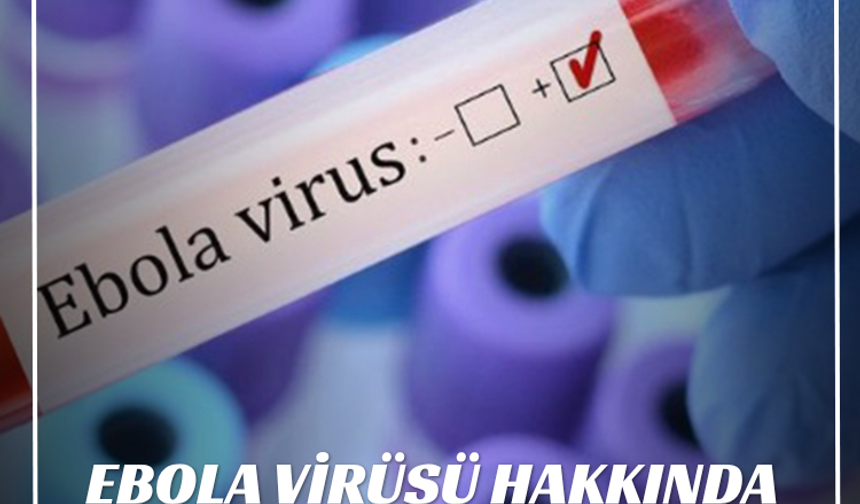 Ebola Virüsü Hakkında Bilmeniz Gerekenler: Nedir, Belirtileri Nelerdir?