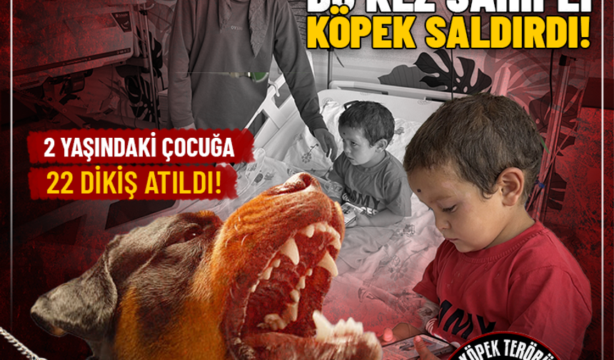 Bu kez sahipli köpek saldırdı: 2 yaşındaki çocuğa 22 dikiş atıldı!