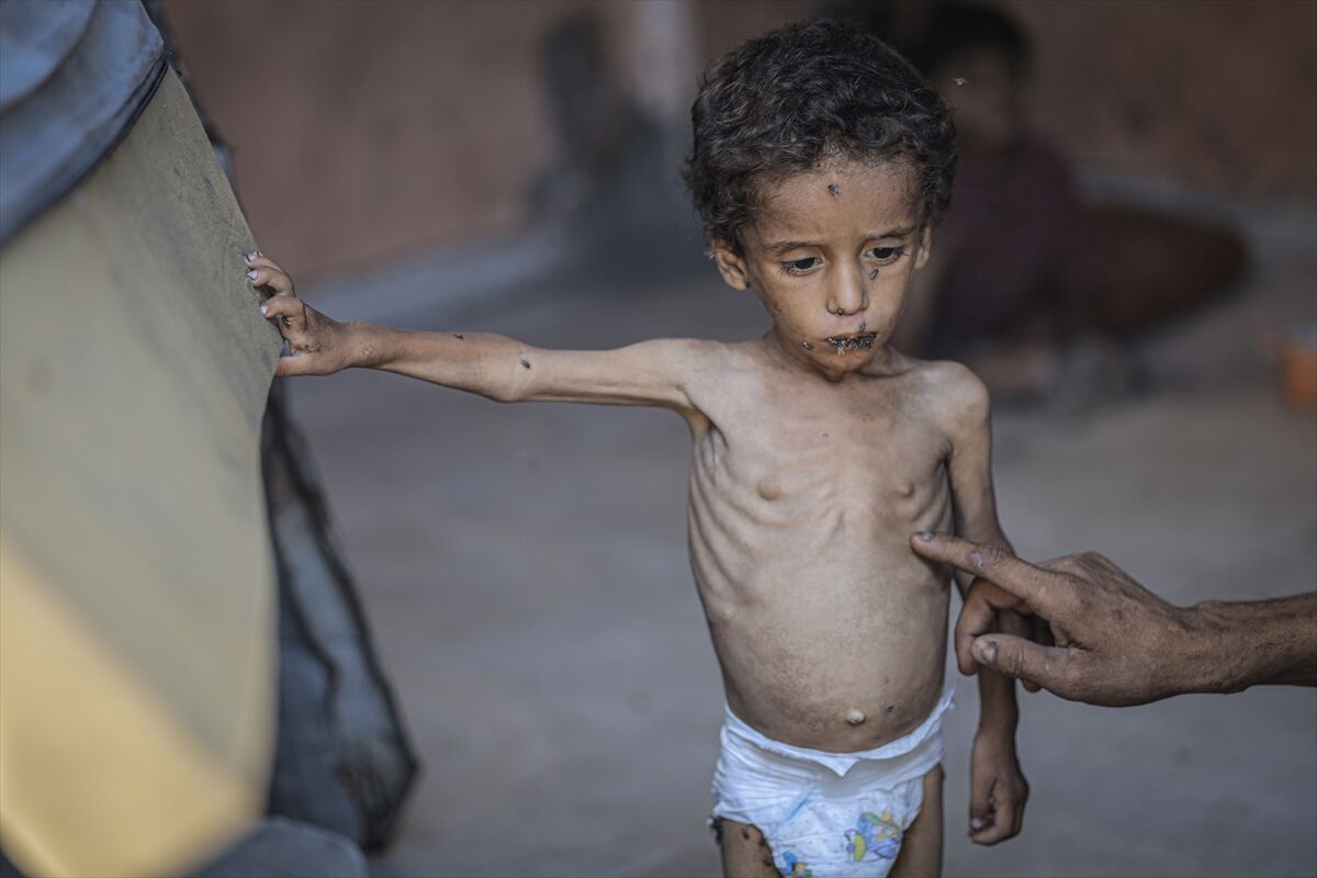 A A 20250714 38554269 38554228 G A Z Z E D E 2 Y A S I N D A K I E B U F U L Y E T E R S I Z B E S L E N M E N E D E N I Y L E H A Y A T I T E H L I K E Y L E K A R S I K A R S I Y A