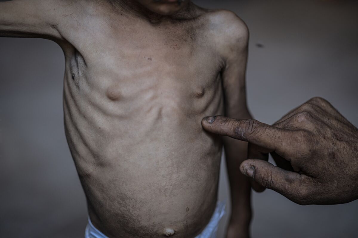 A A 20250714 38554269 38554229 G A Z Z E D E 2 Y A S I N D A K I E B U F U L Y E T E R S I Z B E S L E N M E N E D E N I Y L E H A Y A T I T E H L I K E Y L E K A R S I K A R S I Y A