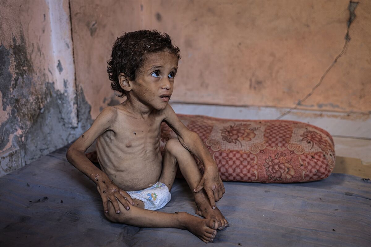 A A 20250714 38554269 38554230 G A Z Z E D E 2 Y A S I N D A K I E B U F U L Y E T E R S I Z B E S L E N M E N E D E N I Y L E H A Y A T I T E H L I K E Y L E K A R S I K A R S I Y A