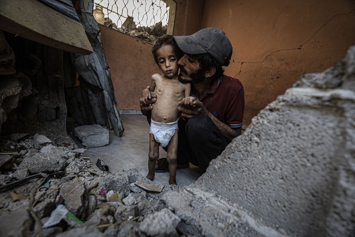 A A 20250714 38554269 38554231 G A Z Z E D E 2 Y A S I N D A K I E B U F U L Y E T E R S I Z B E S L E N M E N E D E N I Y L E H A Y A T I T E H L I K E Y L E K A R S I K A R S I Y A