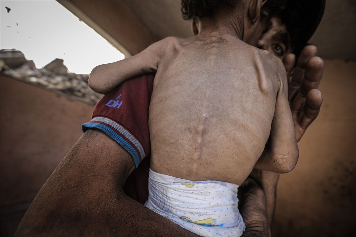 A A 20250714 38554269 38554233 G A Z Z E D E 2 Y A S I N D A K I E B U F U L Y E T E R S I Z B E S L E N M E N E D E N I Y L E H A Y A T I T E H L I K E Y L E K A R S I K A R S I Y A