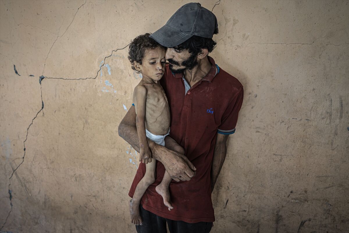 A A 20250714 38554269 38554235 G A Z Z E D E 2 Y A S I N D A K I E B U F U L Y E T E R S I Z B E S L E N M E N E D E N I Y L E H A Y A T I T E H L I K E Y L E K A R S I K A R S I Y A