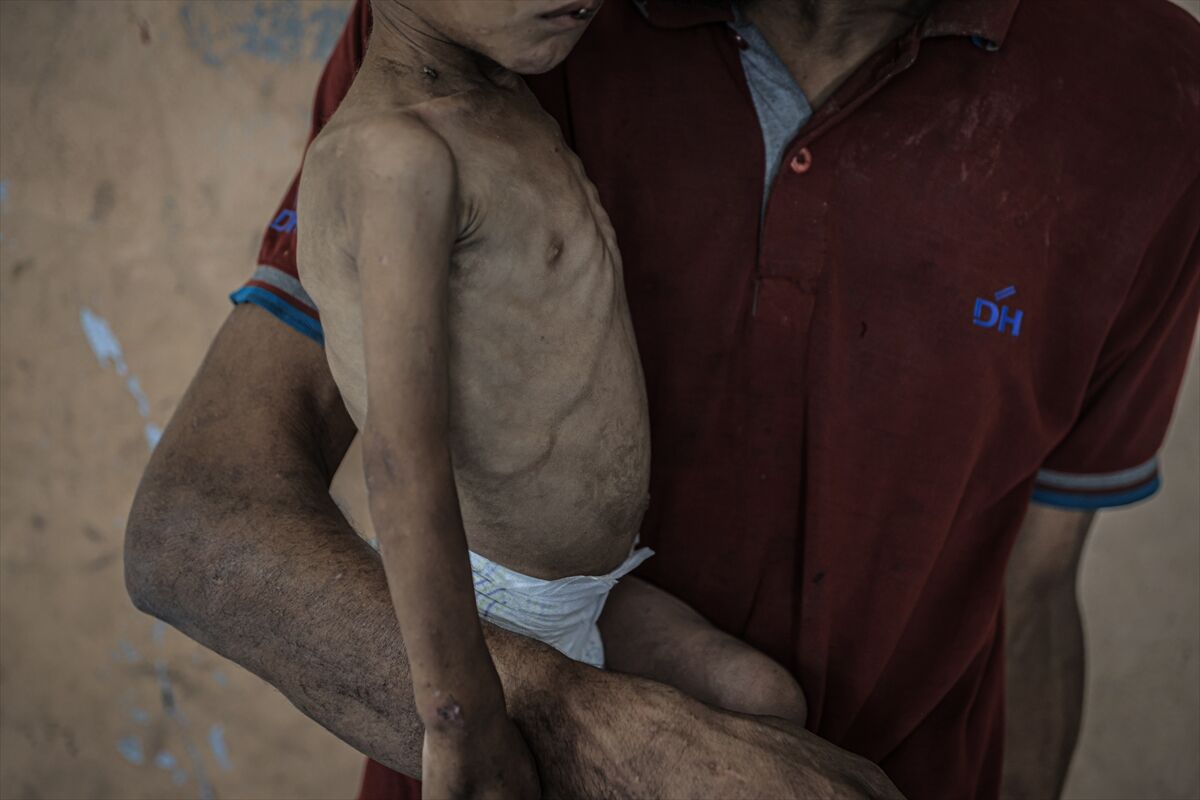 A A 20250714 38554269 38554236 G A Z Z E D E 2 Y A S I N D A K I E B U F U L Y E T E R S I Z B E S L E N M E N E D E N I Y L E H A Y A T I T E H L I K E Y L E K A R S I K A R S I Y A