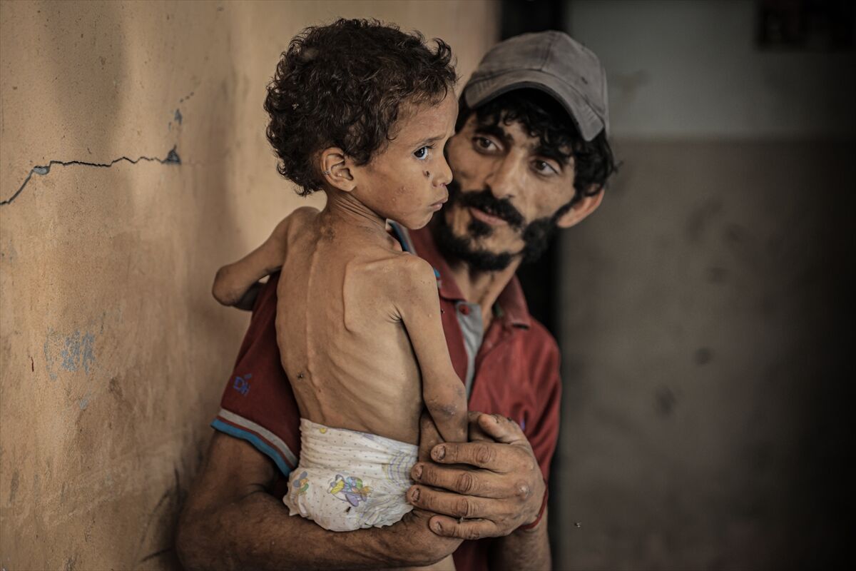 A A 20250714 38554269 38554238 G A Z Z E D E 2 Y A S I N D A K I E B U F U L Y E T E R S I Z B E S L E N M E N E D E N I Y L E H A Y A T I T E H L I K E Y L E K A R S I K A R S I Y A