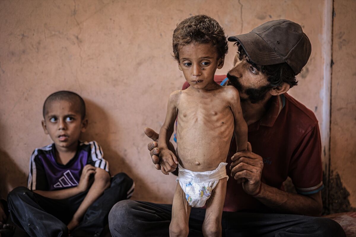 A A 20250714 38554269 38554242 G A Z Z E D E 2 Y A S I N D A K I E B U F U L Y E T E R S I Z B E S L E N M E N E D E N I Y L E H A Y A T I T E H L I K E Y L E K A R S I K A R S I Y A