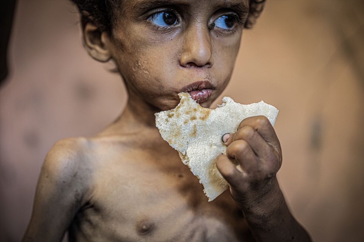 A A 20250714 38554269 38554249 G A Z Z E D E 2 Y A S I N D A K I E B U F U L Y E T E R S I Z B E S L E N M E N E D E N I Y L E H A Y A T I T E H L I K E Y L E K A R S I K A R S I Y A