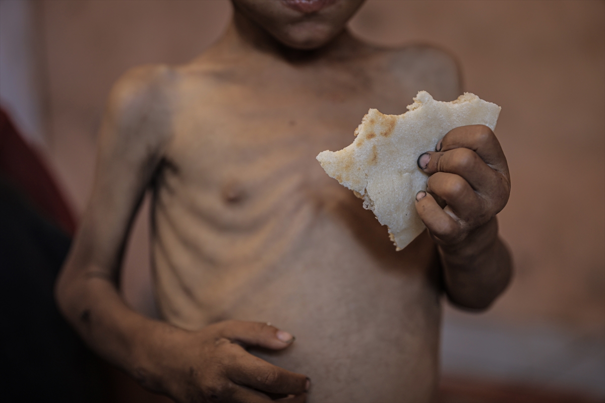 A A 20250714 38554269 38554250 G A Z Z E D E 2 Y A S I N D A K I E B U F U L Y E T E R S I Z B E S L E N M E N E D E N I Y L E H A Y A T I T E H L I K E Y L E K A R S I K A R S I Y A