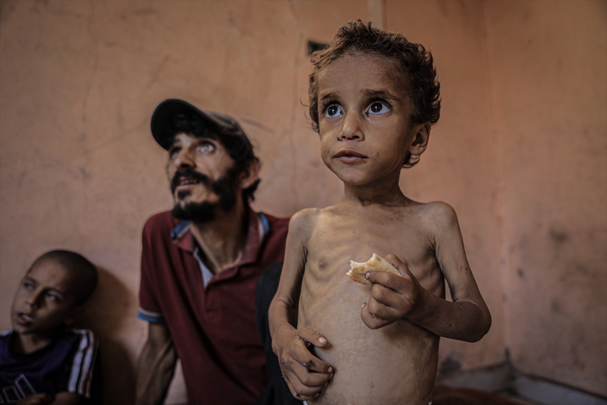 A A 20250714 38554269 38554252 G A Z Z E D E 2 Y A S I N D A K I E B U F U L Y E T E R S I Z B E S L E N M E N E D E N I Y L E H A Y A T I T E H L I K E Y L E K A R S I K A R S I Y A