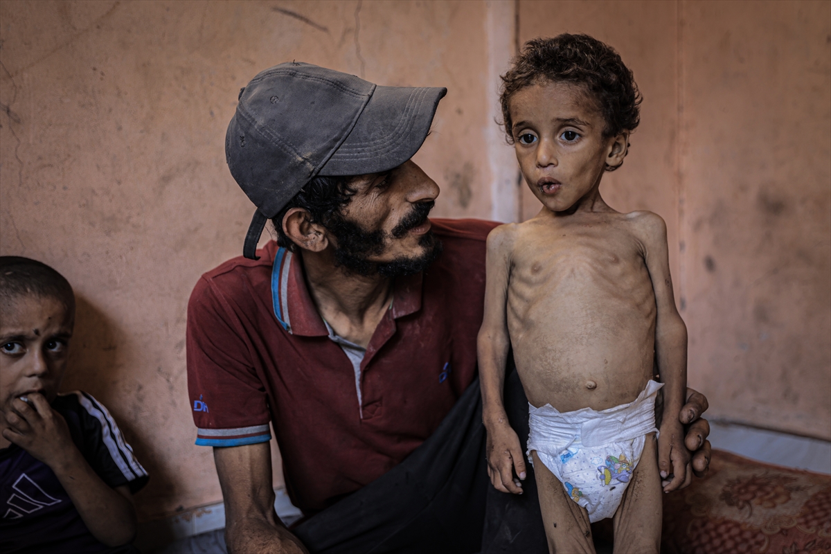 A A 20250714 38554269 38554257 G A Z Z E D E 2 Y A S I N D A K I E B U F U L Y E T E R S I Z B E S L E N M E N E D E N I Y L E H A Y A T I T E H L I K E Y L E K A R S I K A R S I Y A