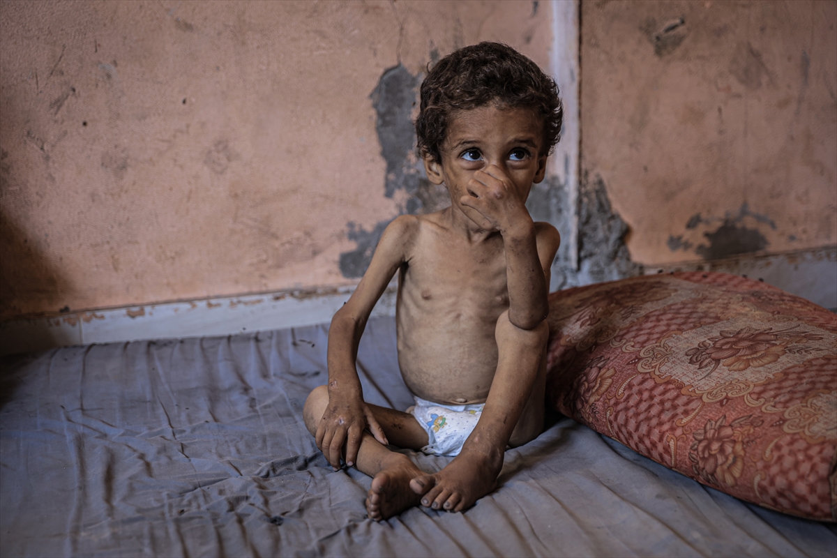 A A 20250714 38554269 38554258 G A Z Z E D E 2 Y A S I N D A K I E B U F U L Y E T E R S I Z B E S L E N M E N E D E N I Y L E H A Y A T I T E H L I K E Y L E K A R S I K A R S I Y A