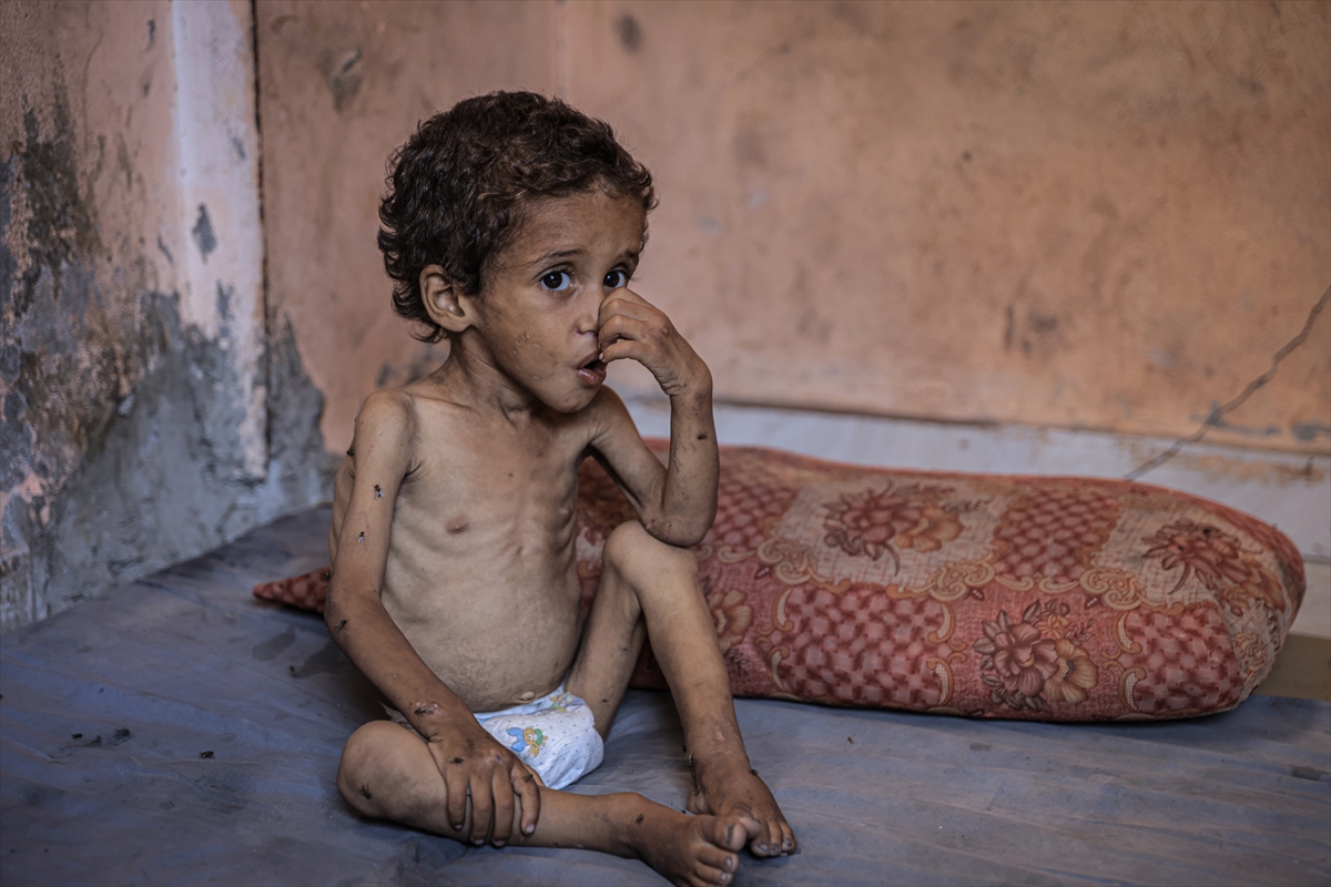 A A 20250714 38554269 38554260 G A Z Z E D E 2 Y A S I N D A K I E B U F U L Y E T E R S I Z B E S L E N M E N E D E N I Y L E H A Y A T I T E H L I K E Y L E K A R S I K A R S I Y A