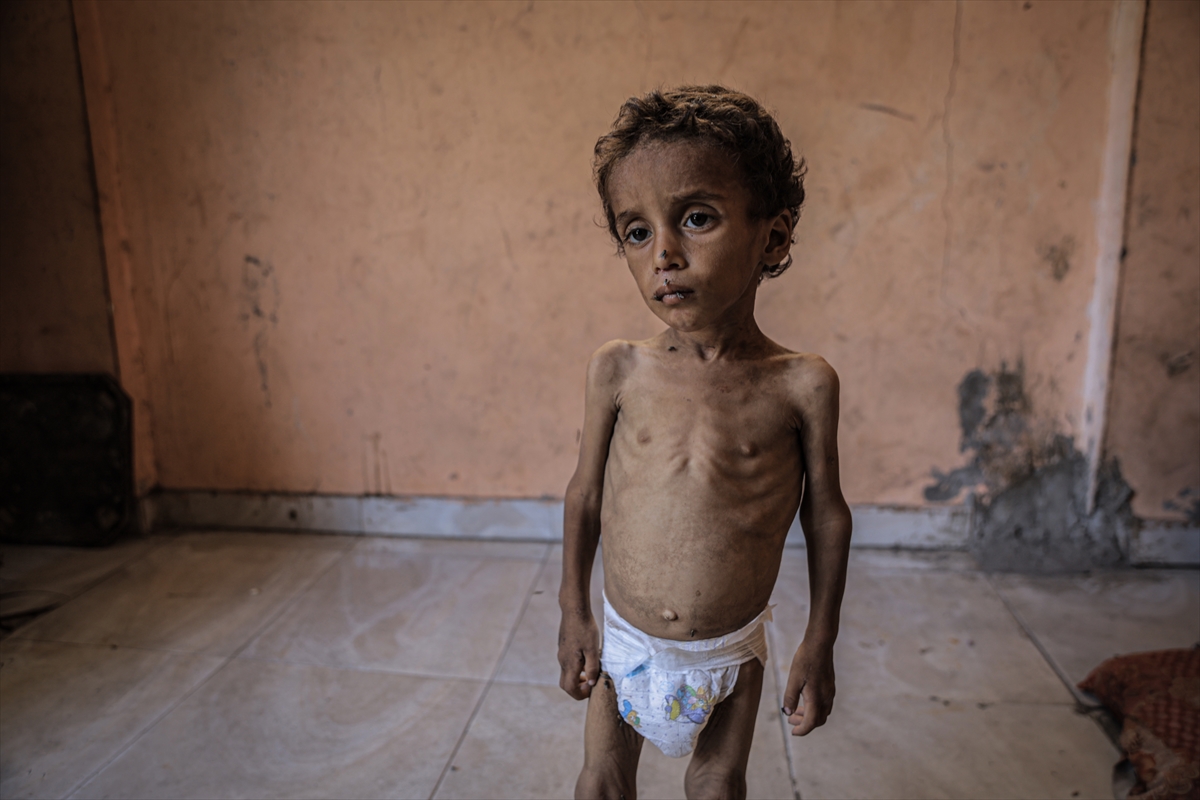 A A 20250714 38554269 38554262 G A Z Z E D E 2 Y A S I N D A K I E B U F U L Y E T E R S I Z B E S L E N M E N E D E N I Y L E H A Y A T I T E H L I K E Y L E K A R S I K A R S I Y A