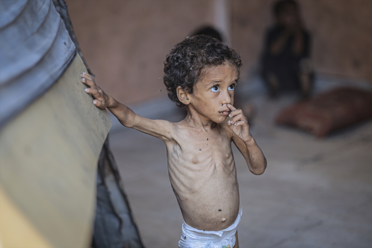 A A 20250714 38554269 38554264 G A Z Z E D E 2 Y A S I N D A K I E B U F U L Y E T E R S I Z B E S L E N M E N E D E N I Y L E H A Y A T I T E H L I K E Y L E K A R S I K A R S I Y A