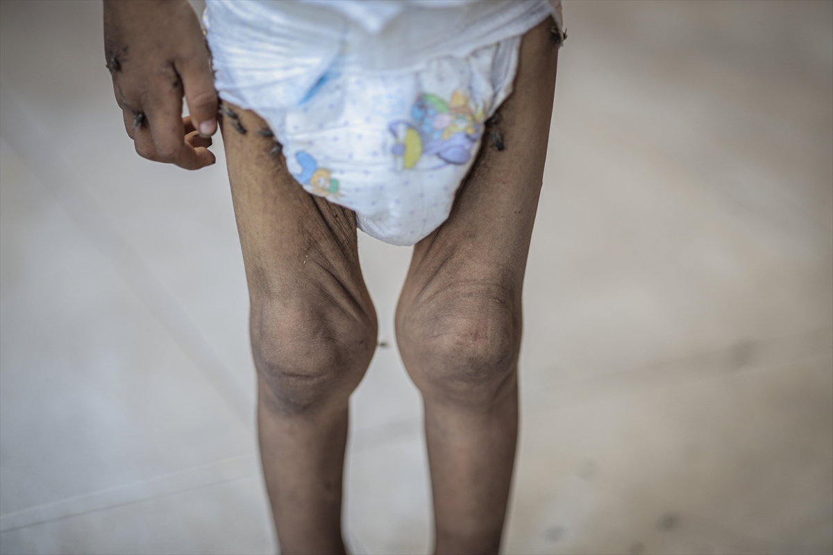 A A 20250714 38554269 38554266 G A Z Z E D E 2 Y A S I N D A K I E B U F U L Y E T E R S I Z B E S L E N M E N E D E N I Y L E H A Y A T I T E H L I K E Y L E K A R S I K A R S I Y A