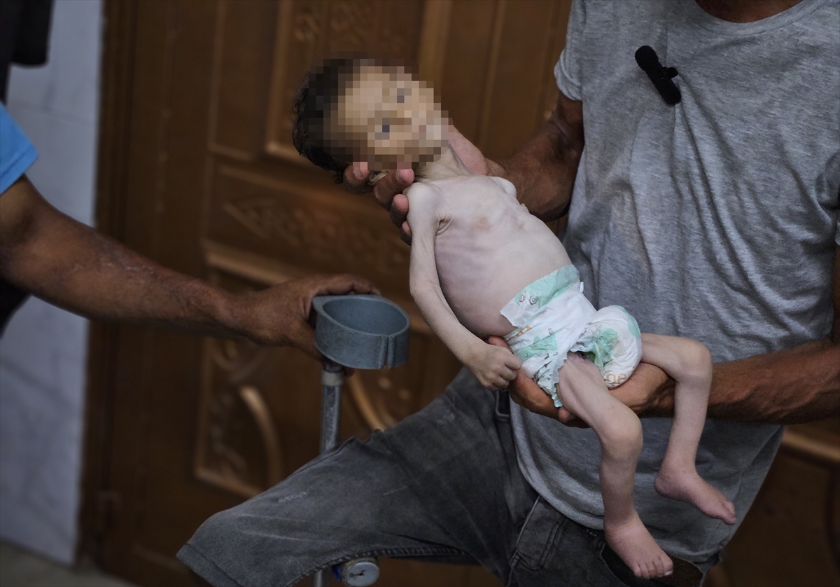 A A 20250719 38605907 38605896 G A Z Z E D E Y E T E R S I Z B E S L E N M E N E D E N I Y L E B I R B E B E K D A H A H A Y A T I N I K A Y B E T T I