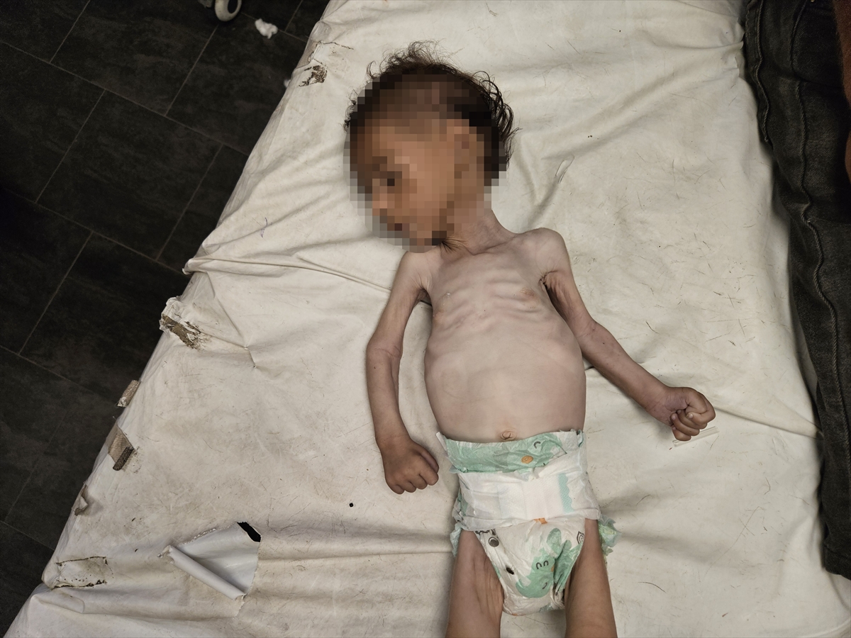 A A 20250719 38605907 38605897 G A Z Z E D E Y E T E R S I Z B E S L E N M E N E D E N I Y L E B I R B E B E K D A H A H A Y A T I N I K A Y B E T T I