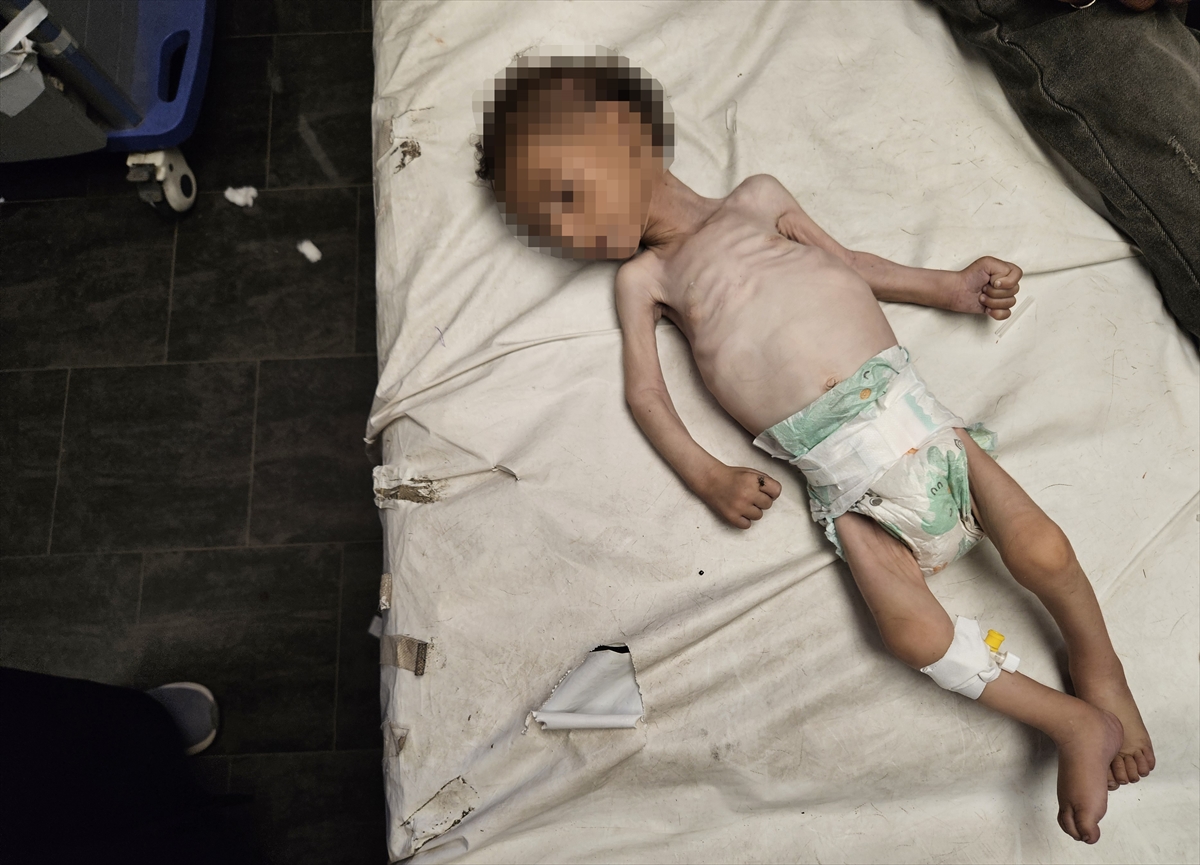 A A 20250719 38605907 38605898 G A Z Z E D E Y E T E R S I Z B E S L E N M E N E D E N I Y L E B I R B E B E K D A H A H A Y A T I N I K A Y B E T T I