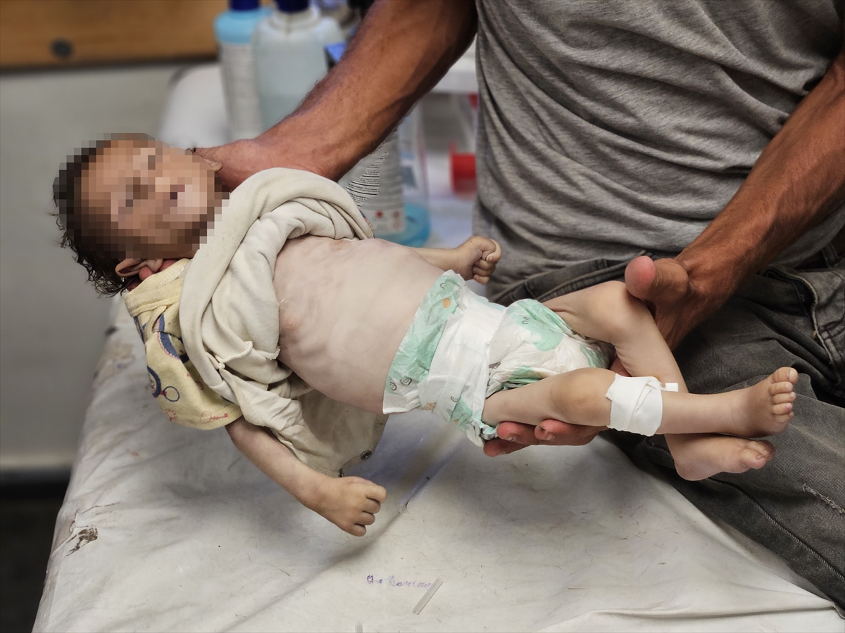 A A 20250719 38605907 38605899 G A Z Z E D E Y E T E R S I Z B E S L E N M E N E D E N I Y L E B I R B E B E K D A H A H A Y A T I N I K A Y B E T T I