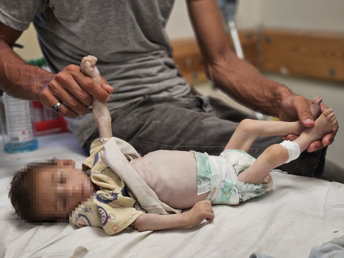 A A 20250719 38605907 38605900 G A Z Z E D E Y E T E R S I Z B E S L E N M E N E D E N I Y L E B I R B E B E K D A H A H A Y A T I N I K A Y B E T T I