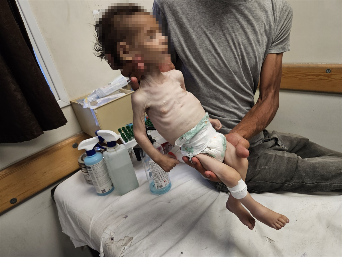 A A 20250719 38605907 38605902 G A Z Z E D E Y E T E R S I Z B E S L E N M E N E D E N I Y L E B I R B E B E K D A H A H A Y A T I N I K A Y B E T T I