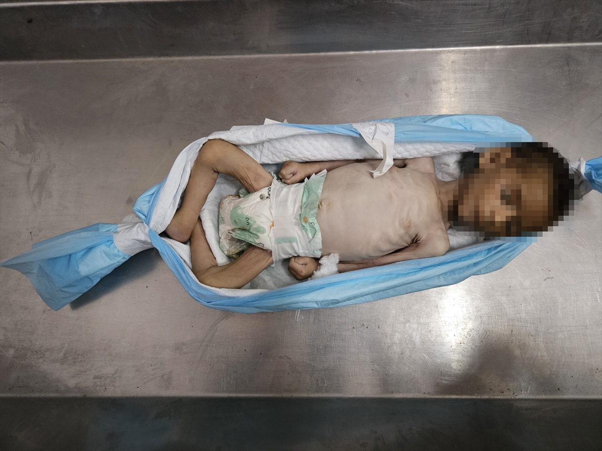 A A 20250719 38605907 38605903 G A Z Z E D E Y E T E R S I Z B E S L E N M E N E D E N I Y L E B I R B E B E K D A H A H A Y A T I N I K A Y B E T T I