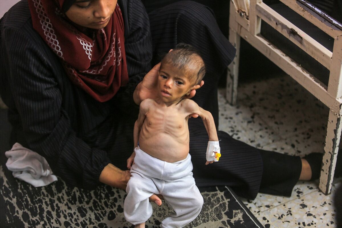 A A 20250724 38649236 38649211 K I T L E S E L A C L I K K R I Z I N I N D E R I N L E S T I G I G A Z Z E D E H A S T A N E L E R O L U M L E P E N C E L E S E N B E B E K L E R L E D O L U P T A S I Y O R