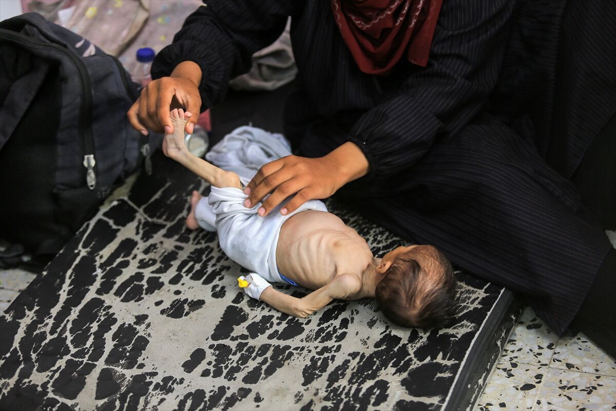 A A 20250724 38649236 38649212 K I T L E S E L A C L I K K R I Z I N I N D E R I N L E S T I G I G A Z Z E D E H A S T A N E L E R O L U M L E P E N C E L E S E N B E B E K L E R L E D O L U P T A S I Y O R