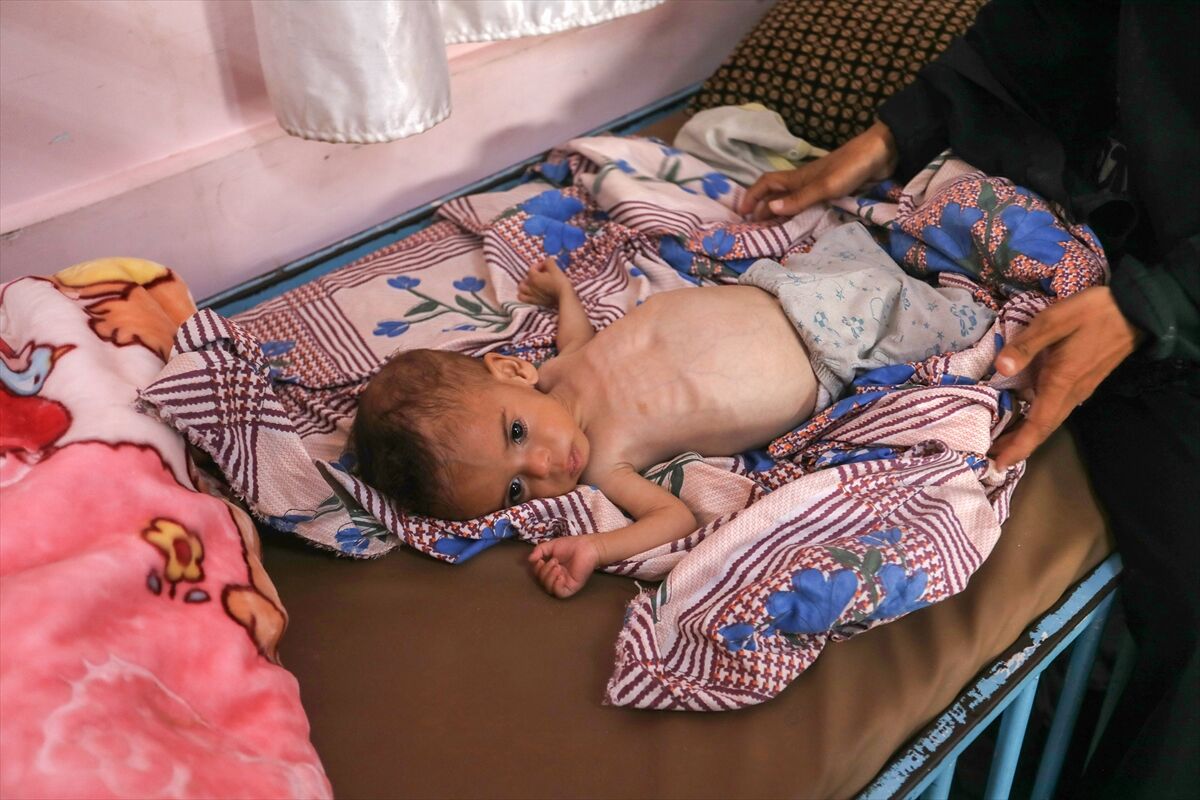 A A 20250724 38649236 38649213 K I T L E S E L A C L I K K R I Z I N I N D E R I N L E S T I G I G A Z Z E D E H A S T A N E L E R O L U M L E P E N C E L E S E N B E B E K L E R L E D O L U P T A S I Y O R