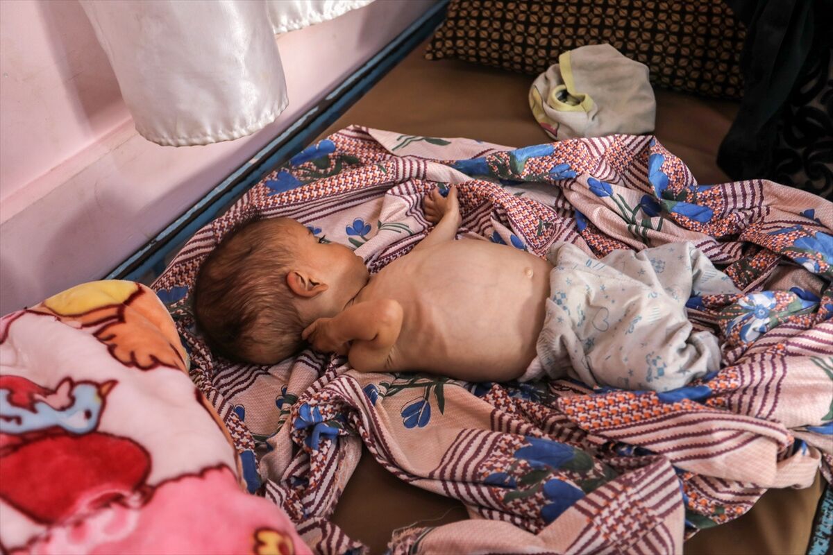 A A 20250724 38649236 38649214 K I T L E S E L A C L I K K R I Z I N I N D E R I N L E S T I G I G A Z Z E D E H A S T A N E L E R O L U M L E P E N C E L E S E N B E B E K L E R L E D O L U P T A S I Y O R