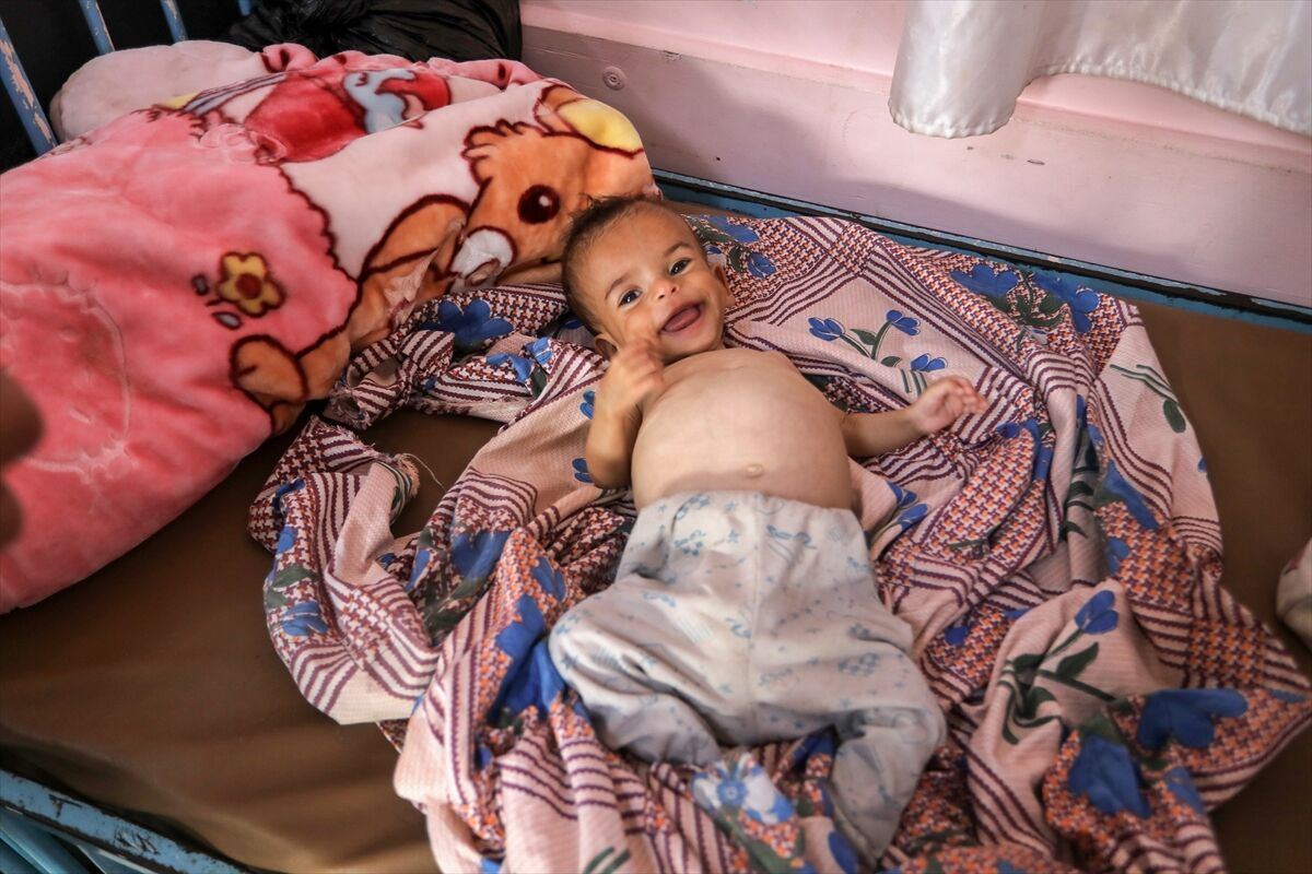 A A 20250724 38649236 38649215 K I T L E S E L A C L I K K R I Z I N I N D E R I N L E S T I G I G A Z Z E D E H A S T A N E L E R O L U M L E P E N C E L E S E N B E B E K L E R L E D O L U P T A S I Y O R