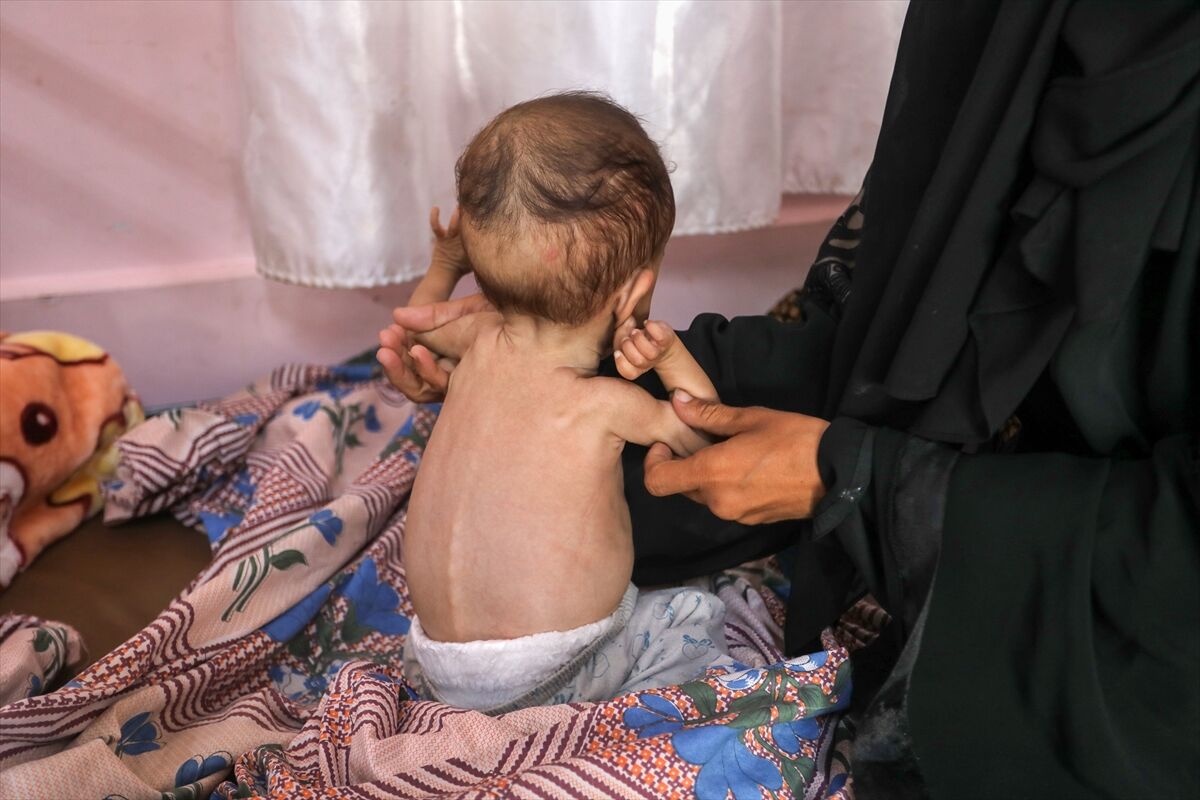 A A 20250724 38649236 38649216 K I T L E S E L A C L I K K R I Z I N I N D E R I N L E S T I G I G A Z Z E D E H A S T A N E L E R O L U M L E P E N C E L E S E N B E B E K L E R L E D O L U P T A S I Y O R