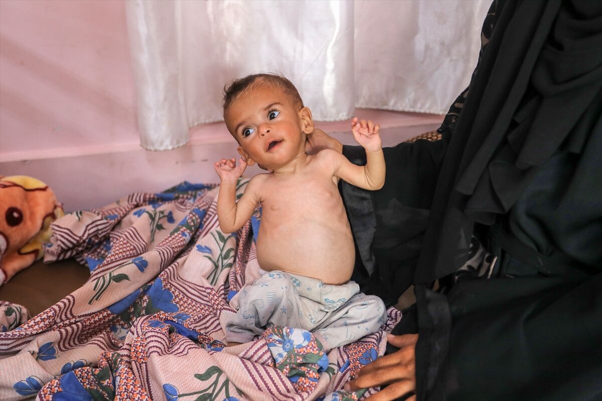 A A 20250724 38649236 38649217 K I T L E S E L A C L I K K R I Z I N I N D E R I N L E S T I G I G A Z Z E D E H A S T A N E L E R O L U M L E P E N C E L E S E N B E B E K L E R L E D O L U P T A S I Y O R