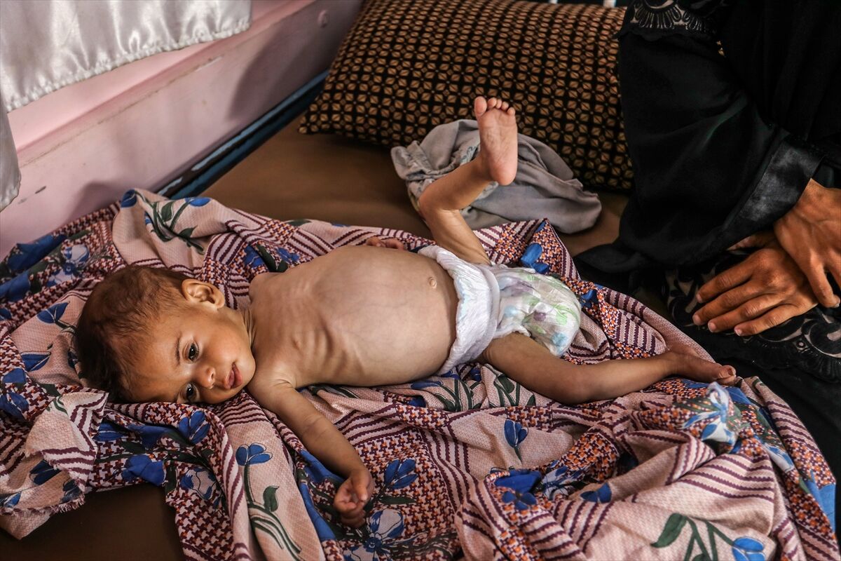 A A 20250724 38649236 38649218 K I T L E S E L A C L I K K R I Z I N I N D E R I N L E S T I G I G A Z Z E D E H A S T A N E L E R O L U M L E P E N C E L E S E N B E B E K L E R L E D O L U P T A S I Y O R