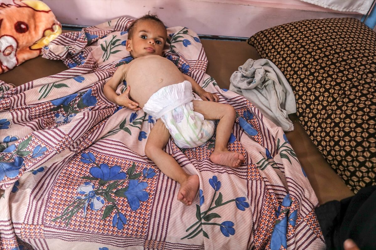 A A 20250724 38649236 38649220 K I T L E S E L A C L I K K R I Z I N I N D E R I N L E S T I G I G A Z Z E D E H A S T A N E L E R O L U M L E P E N C E L E S E N B E B E K L E R L E D O L U P T A S I Y O R