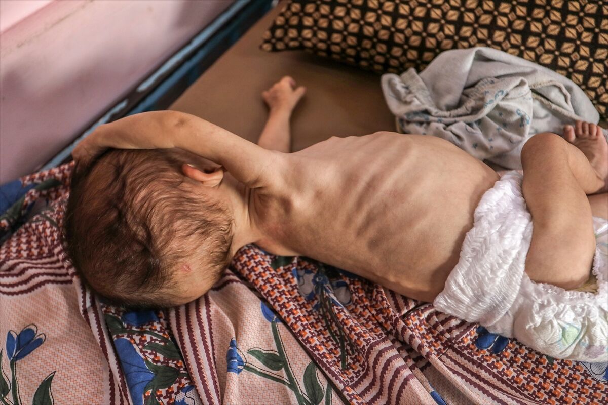 A A 20250724 38649236 38649221 K I T L E S E L A C L I K K R I Z I N I N D E R I N L E S T I G I G A Z Z E D E H A S T A N E L E R O L U M L E P E N C E L E S E N B E B E K L E R L E D O L U P T A S I Y O R