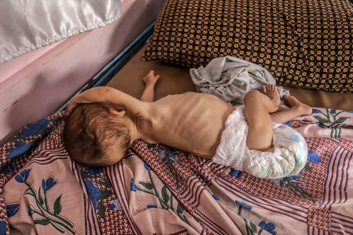 A A 20250724 38649236 38649222 K I T L E S E L A C L I K K R I Z I N I N D E R I N L E S T I G I G A Z Z E D E H A S T A N E L E R O L U M L E P E N C E L E S E N B E B E K L E R L E D O L U P T A S I Y O R