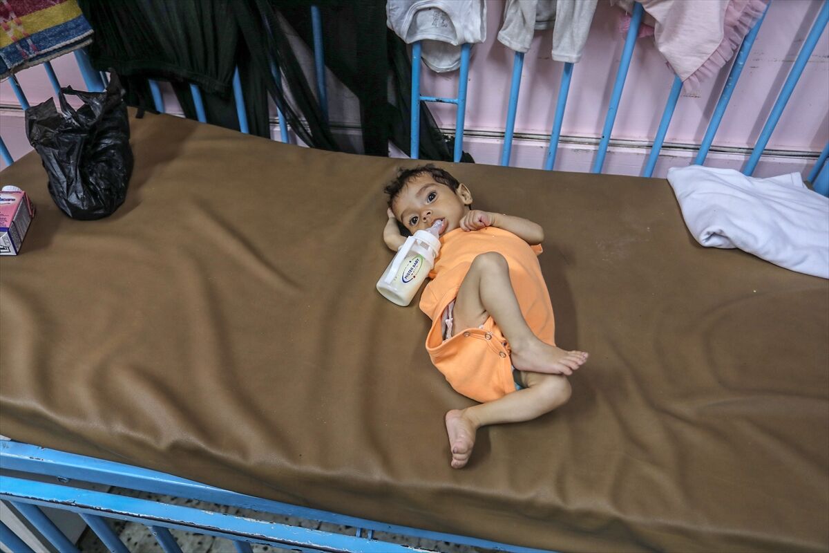 A A 20250724 38649236 38649223 K I T L E S E L A C L I K K R I Z I N I N D E R I N L E S T I G I G A Z Z E D E H A S T A N E L E R O L U M L E P E N C E L E S E N B E B E K L E R L E D O L U P T A S I Y O R