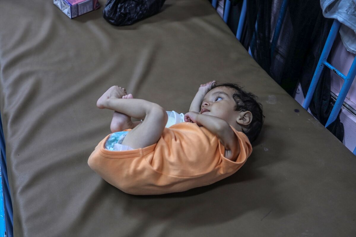 A A 20250724 38649236 38649225 K I T L E S E L A C L I K K R I Z I N I N D E R I N L E S T I G I G A Z Z E D E H A S T A N E L E R O L U M L E P E N C E L E S E N B E B E K L E R L E D O L U P T A S I Y O R