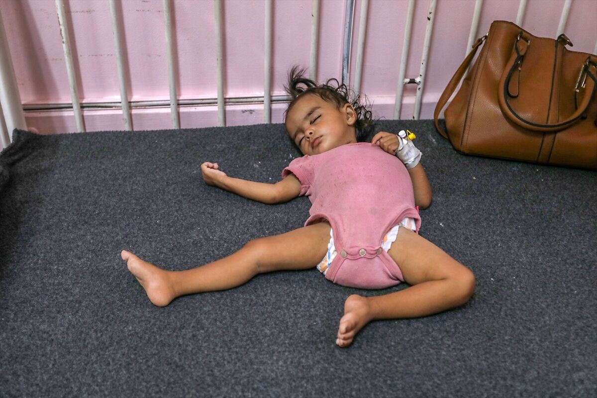 A A 20250724 38649236 38649226 K I T L E S E L A C L I K K R I Z I N I N D E R I N L E S T I G I G A Z Z E D E H A S T A N E L E R O L U M L E P E N C E L E S E N B E B E K L E R L E D O L U P T A S I Y O R